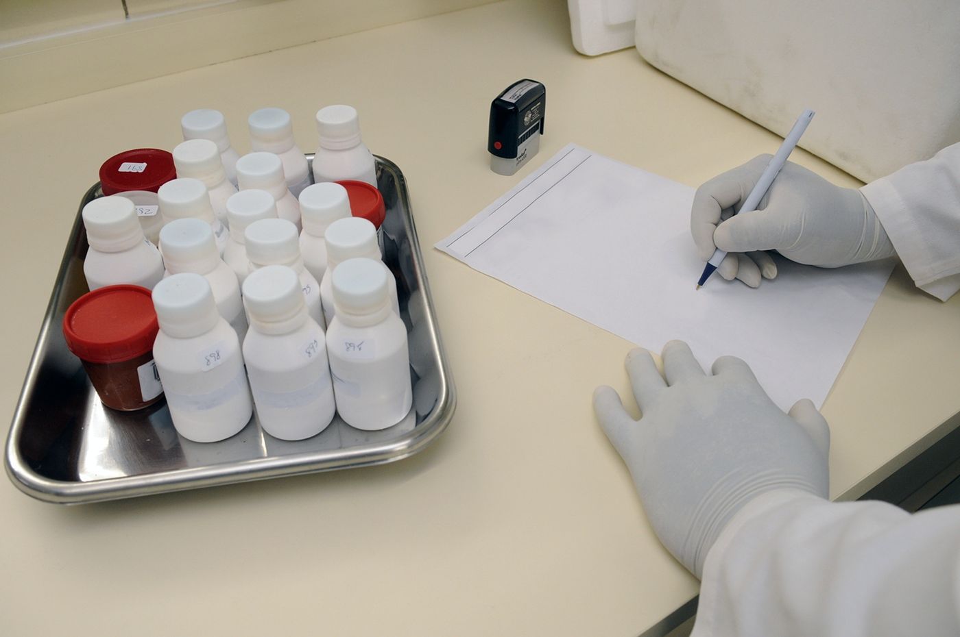 Flacons d’échantillons d’urine prêts pour l’analyse au laboratoire